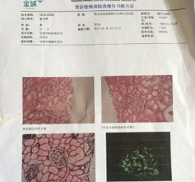 李主任为患者分析检报告